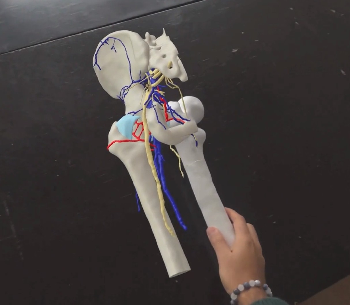 HoloMedicine Guides: mixed-reality 3D anatomy overlaid on a physical model